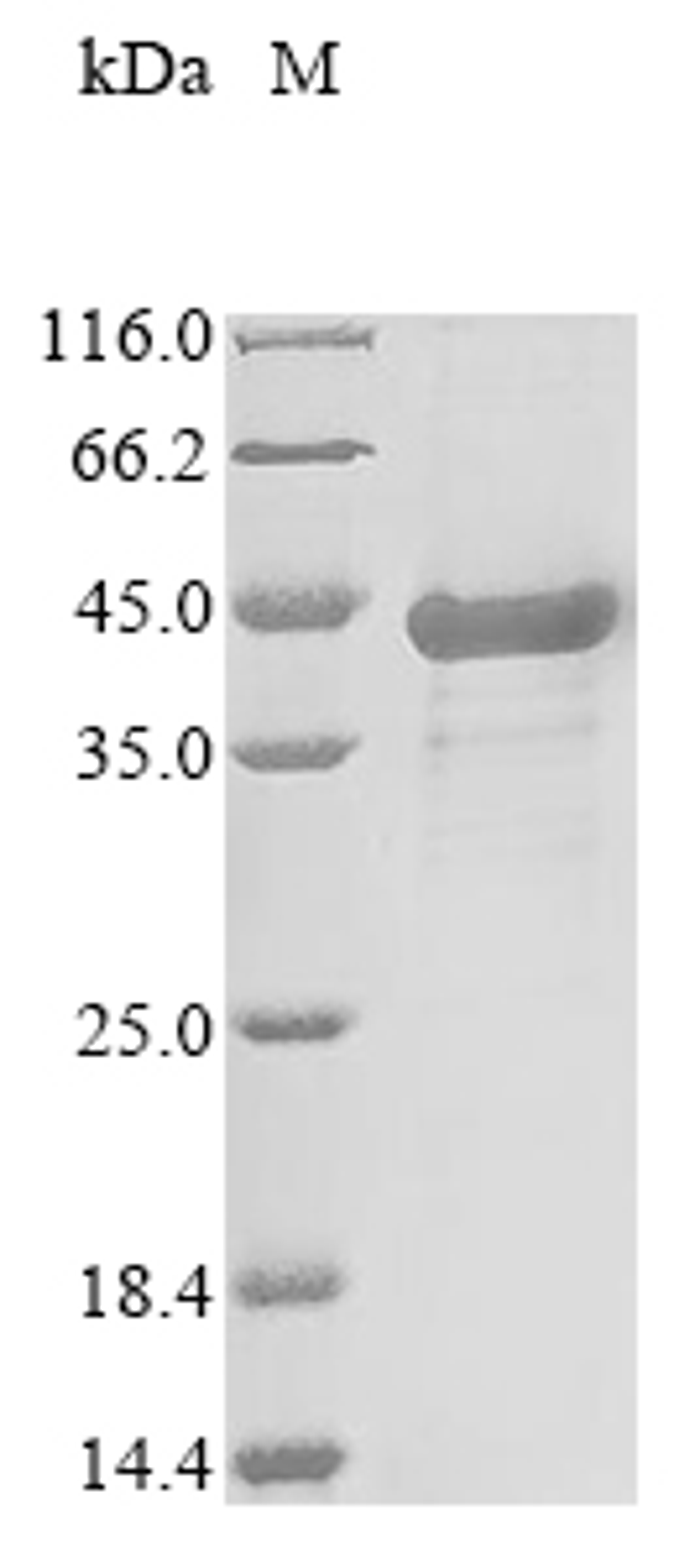 (Tris-Glycine gel) Discontinuous SDS-PAGE (reduced) with 5% enrichment gel and 15% separation gel.