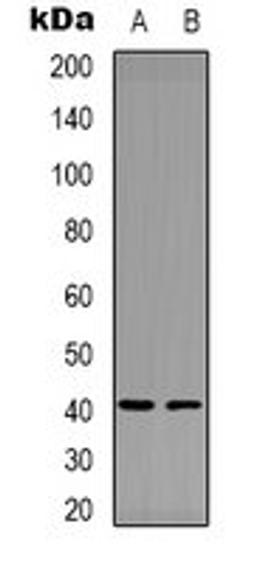 Western blot analysis of MDAMB435 (Lane 1), NIH3T3 (Lane 2) whole cell lysates using Factor XII HC antibody