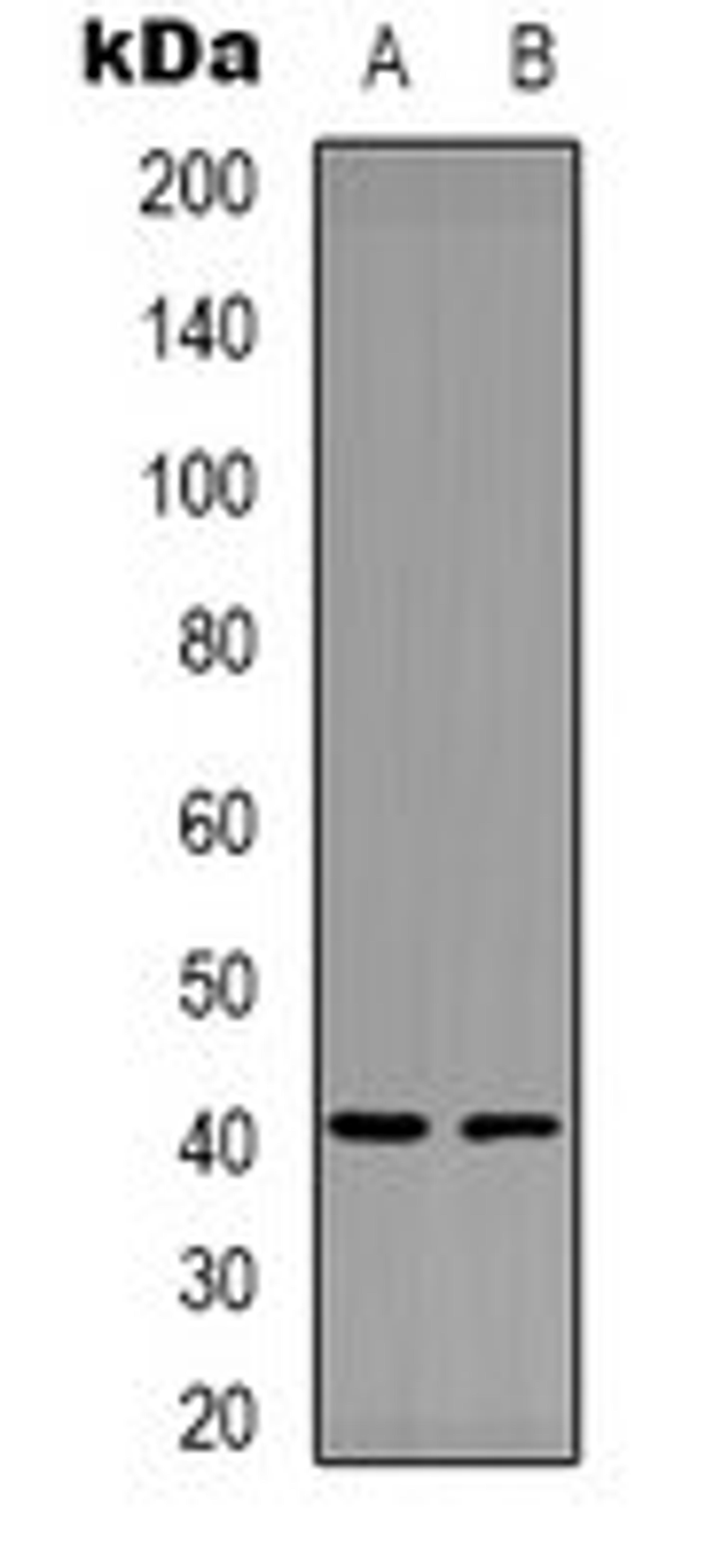 Western blot analysis of MDAMB435 (Lane 1), NIH3T3 (Lane 2) whole cell lysates using Factor XII HC antibody