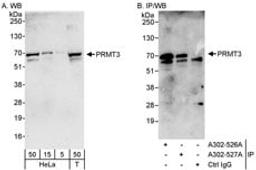 Detection of human PRMT3 by western blot and immunoprecipitation.