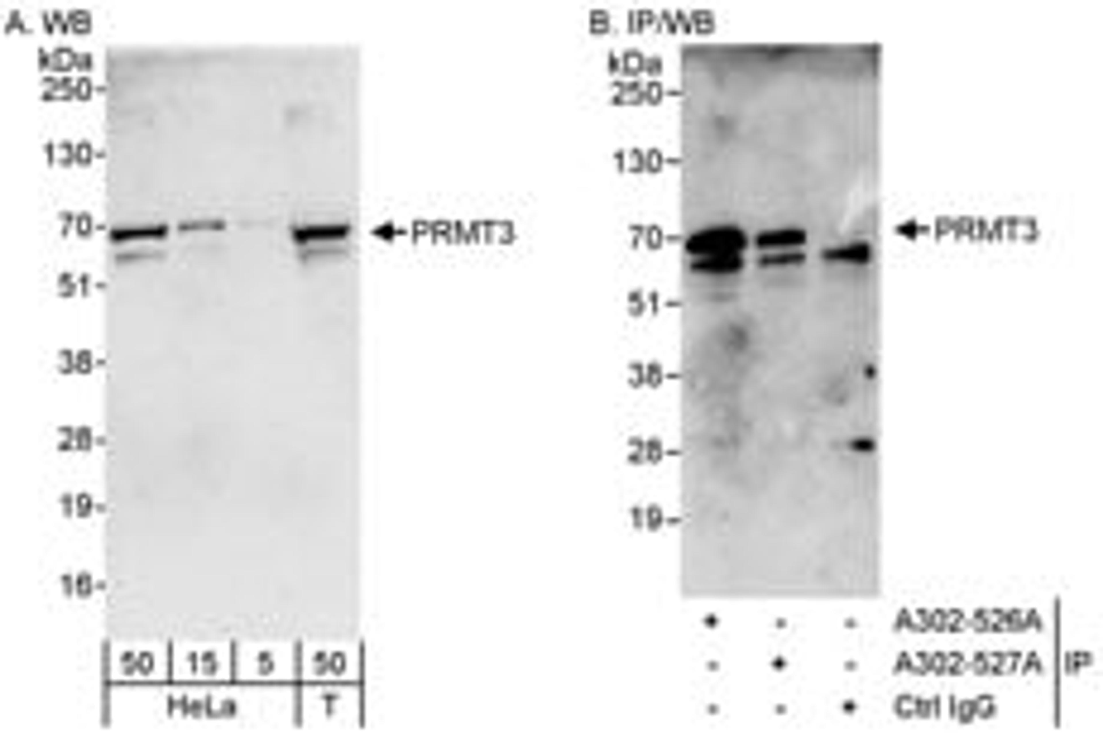 Detection of human PRMT3 by western blot and immunoprecipitation.