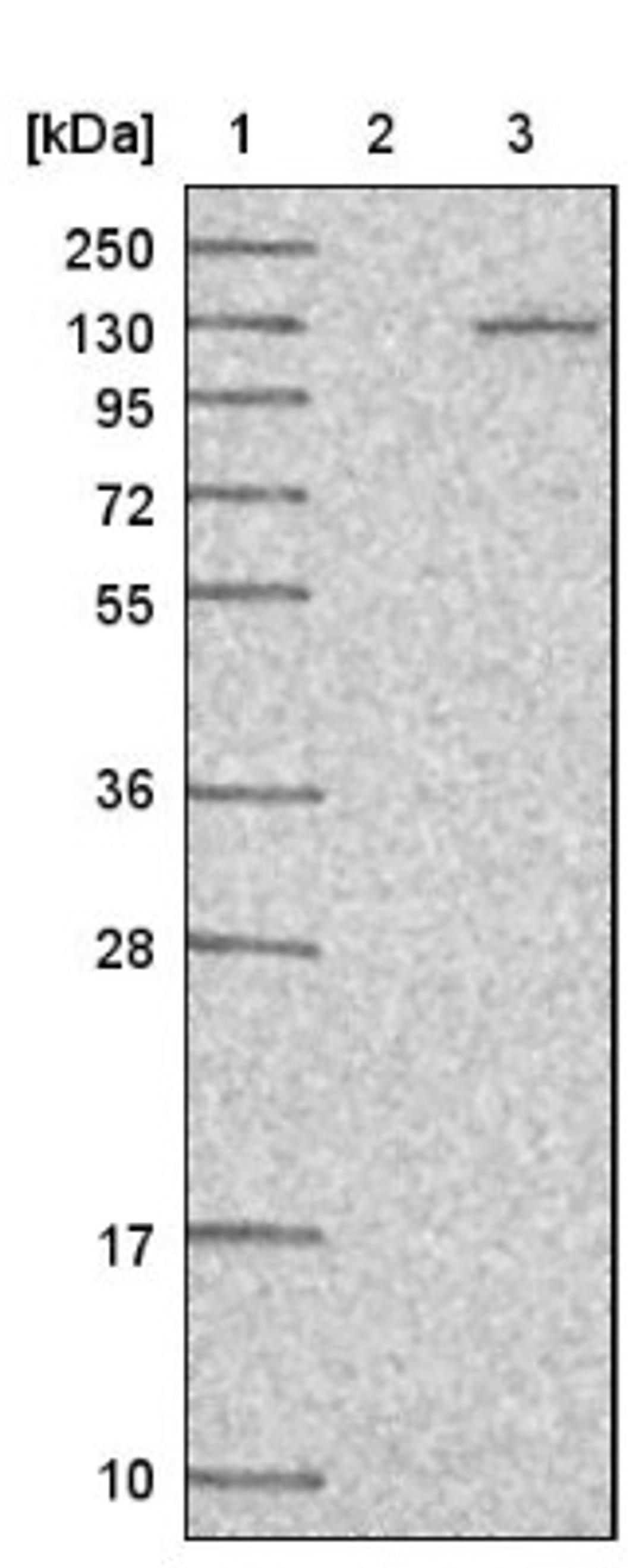 Western Blot: MTBP Antibody [NBP1-86408] - Lane 1: Marker [kDa] 250, 130, 95, 72, 55, 36, 28, 17, 10<br/>Lane 2: Negative control (vector only transfected HEK293T lysate)<br/>Lane 3: Over-expression lysate (Co-expressed with a C-terminal myc-DDK tag (~3.1 kDa) in mammalian HEK293T cells, LY411823)