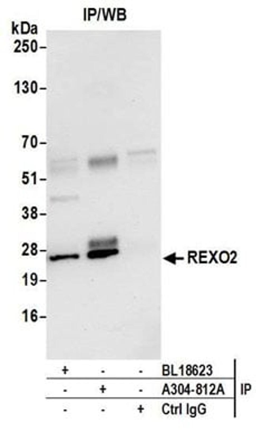 Detection of human REXO2 by western blot of immunoprecipitates.