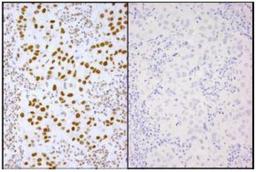 Immunohistochemistry-Paraffin: XRCC1 [p Ser485, p Thr488] Antibody [NB100-541] - See Internal Notes