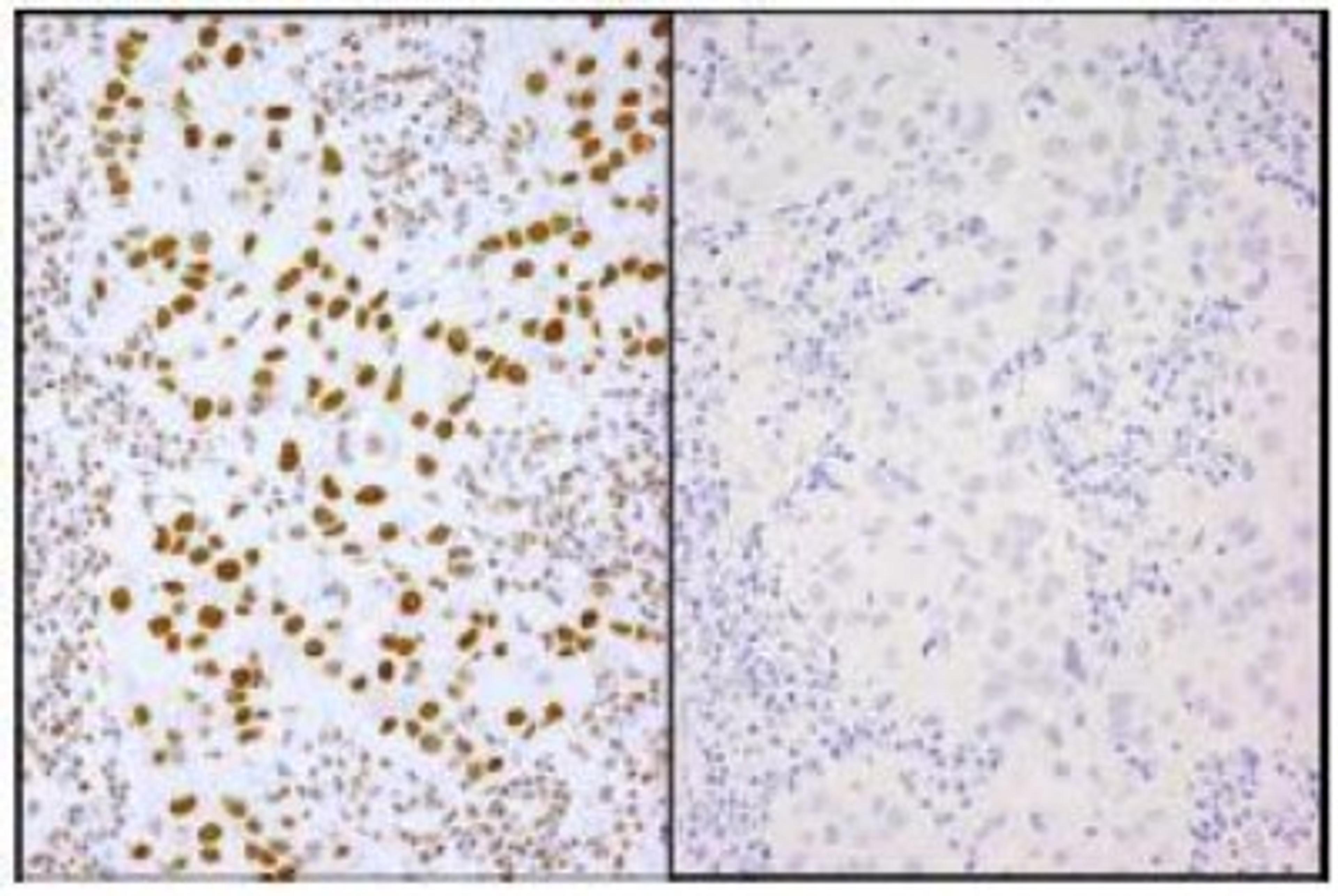 Immunohistochemistry-Paraffin: XRCC1 [p Ser485, p Thr488] Antibody [NB100-541] - See Internal Notes