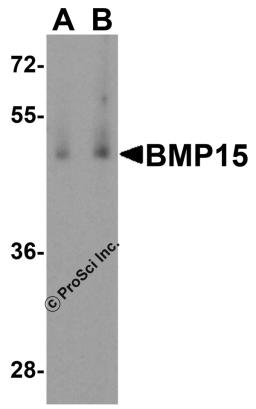 Western blot analysis of BMP15 in human testis tissue lysate with BMP15 antibody at (A) 1 and (B) 2 &#956;g/mL.