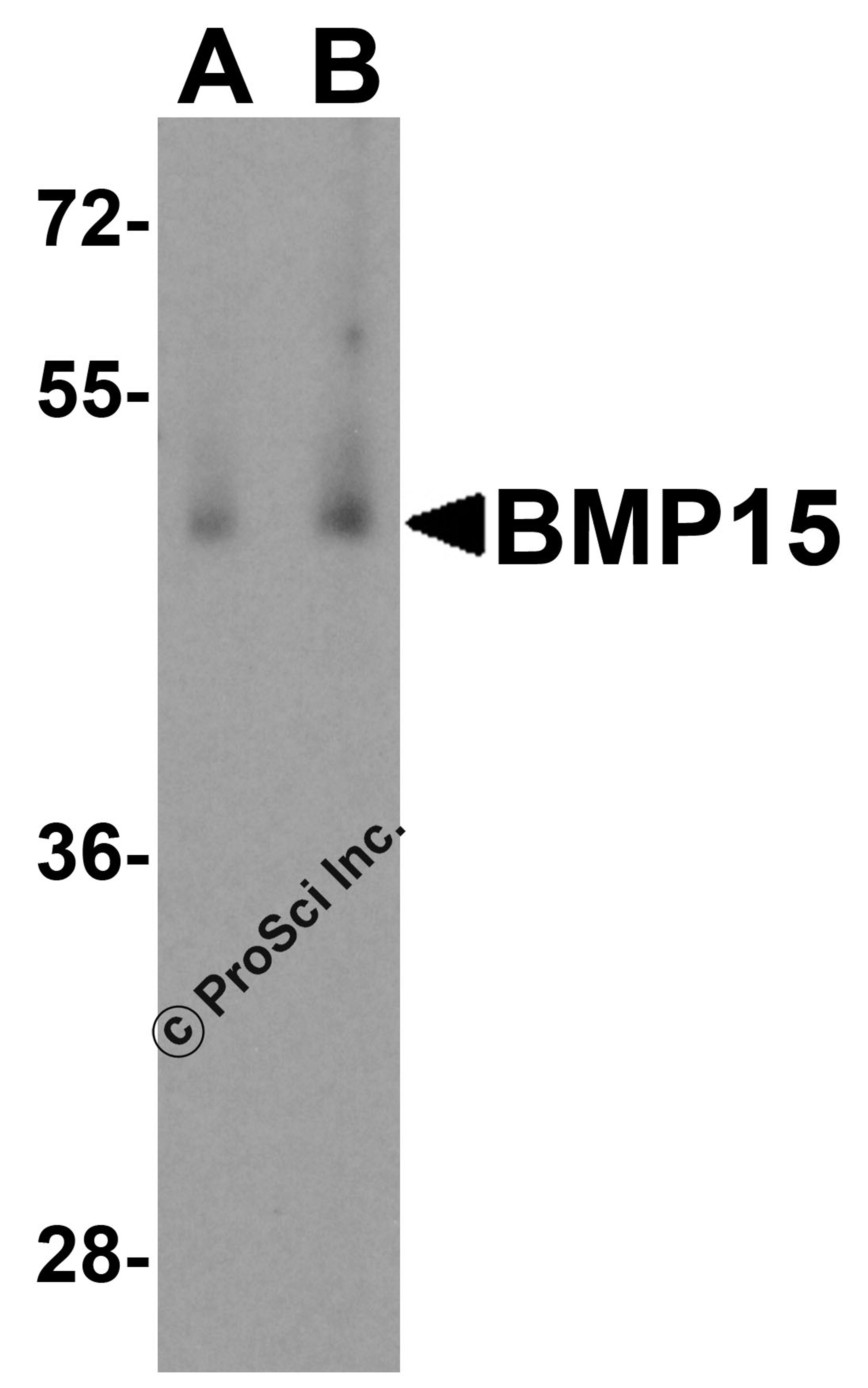 Western blot analysis of BMP15 in human testis tissue lysate with BMP15 antibody at (A) 1 and (B) 2 μg/mL.