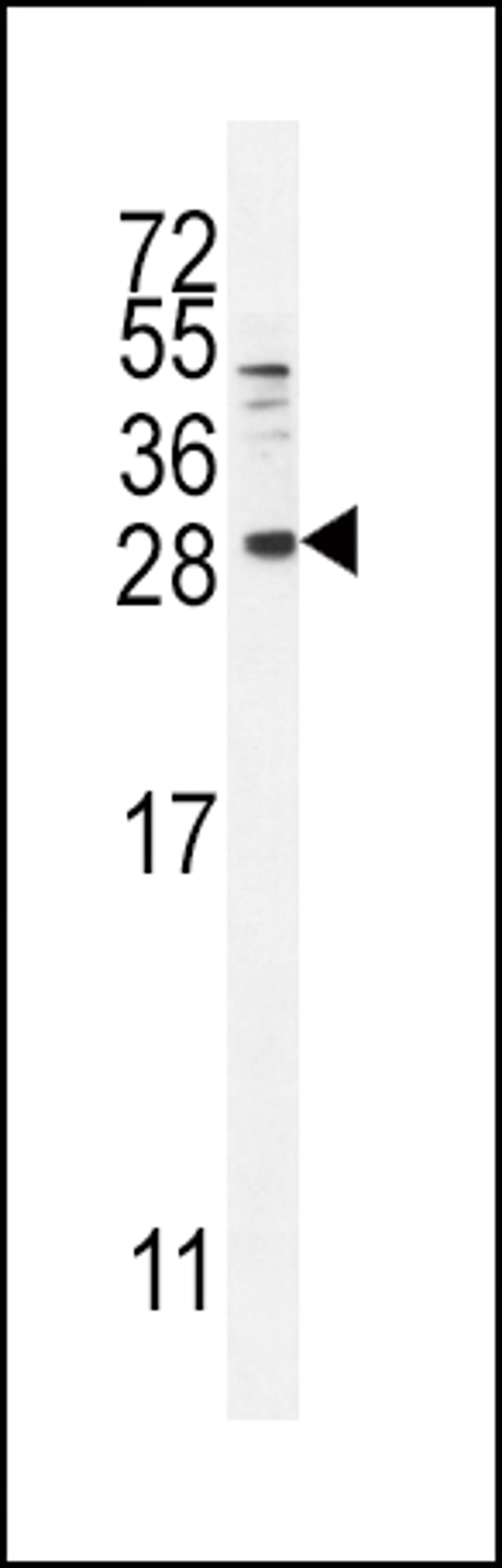 Western blot analysis in MDA-MB231 cell line lysates (35ug/lane).