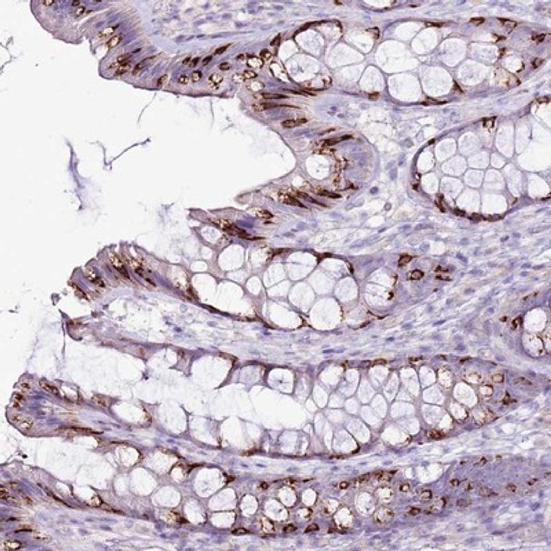 Immunohistochemistry-Paraffin: SLC38A5 Antibody [NBP1-92402] - Immunohistochemical staining of human colon shows strong cytoplasmic positivity in goblet cells.