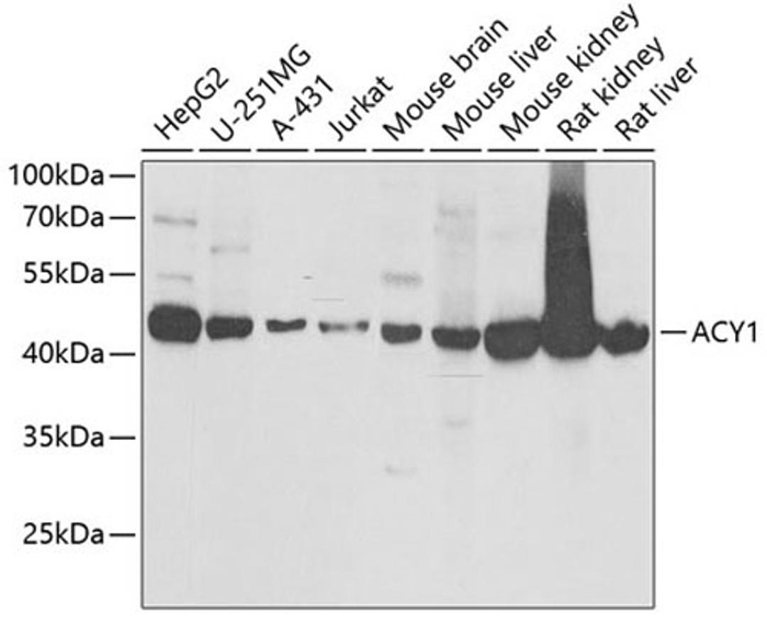 Western blot - ACY1 antibody (A6351)