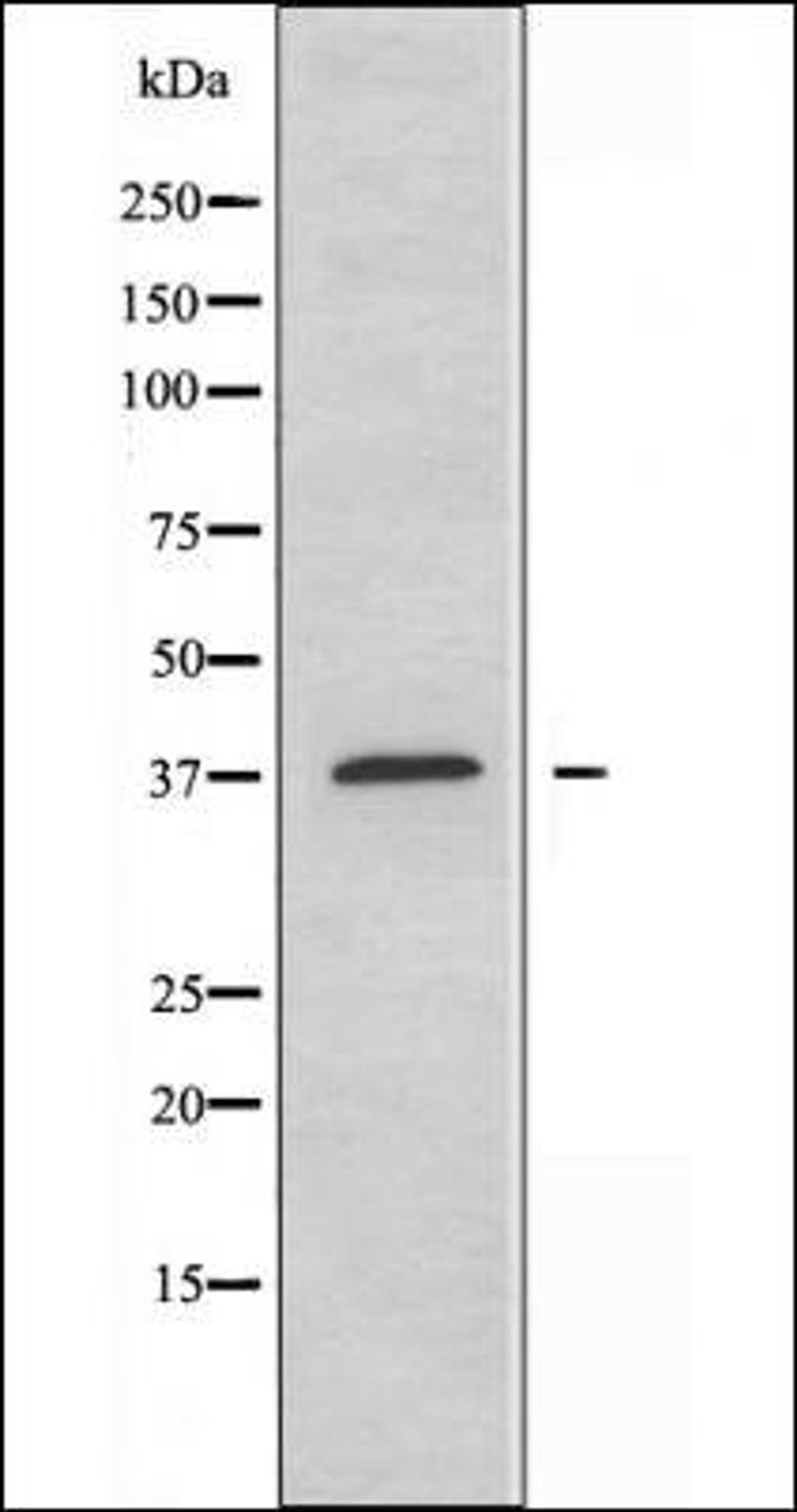 Western blot analysis of mouse brain cells using PKA CAT antibody