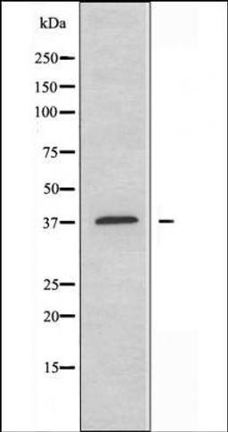 Western blot analysis of mouse brain cells using PKA CAT antibody