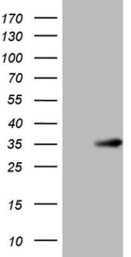 Western Blot: SHP/NR0B2/Nuclear Receptor SHP Antibody (7B5) [NBP2-46522] - Analysis of HEK293T cells were transfected with the pCMV6-ENTRY control (Left lane) or pCMV6-ENTRY NR0B2.