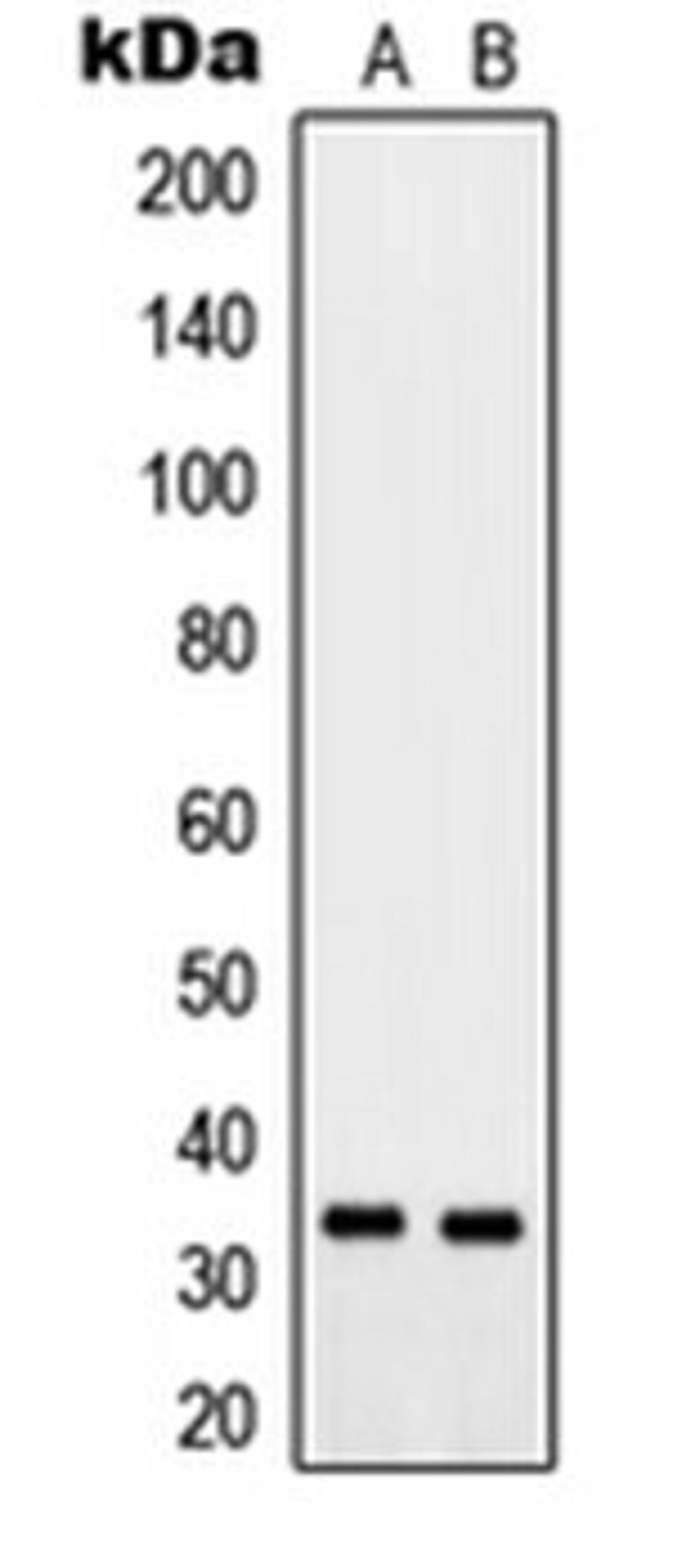 Western blot analysis of MCF7 (Lane 1), PC12 (Lane 2) whole cell lysates using PTGR2 antibody