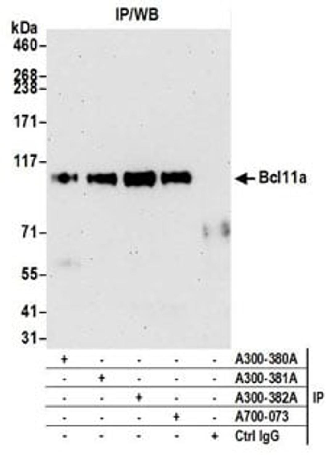 Detection of human Bcl11a by western blot of immunoprecipitates.