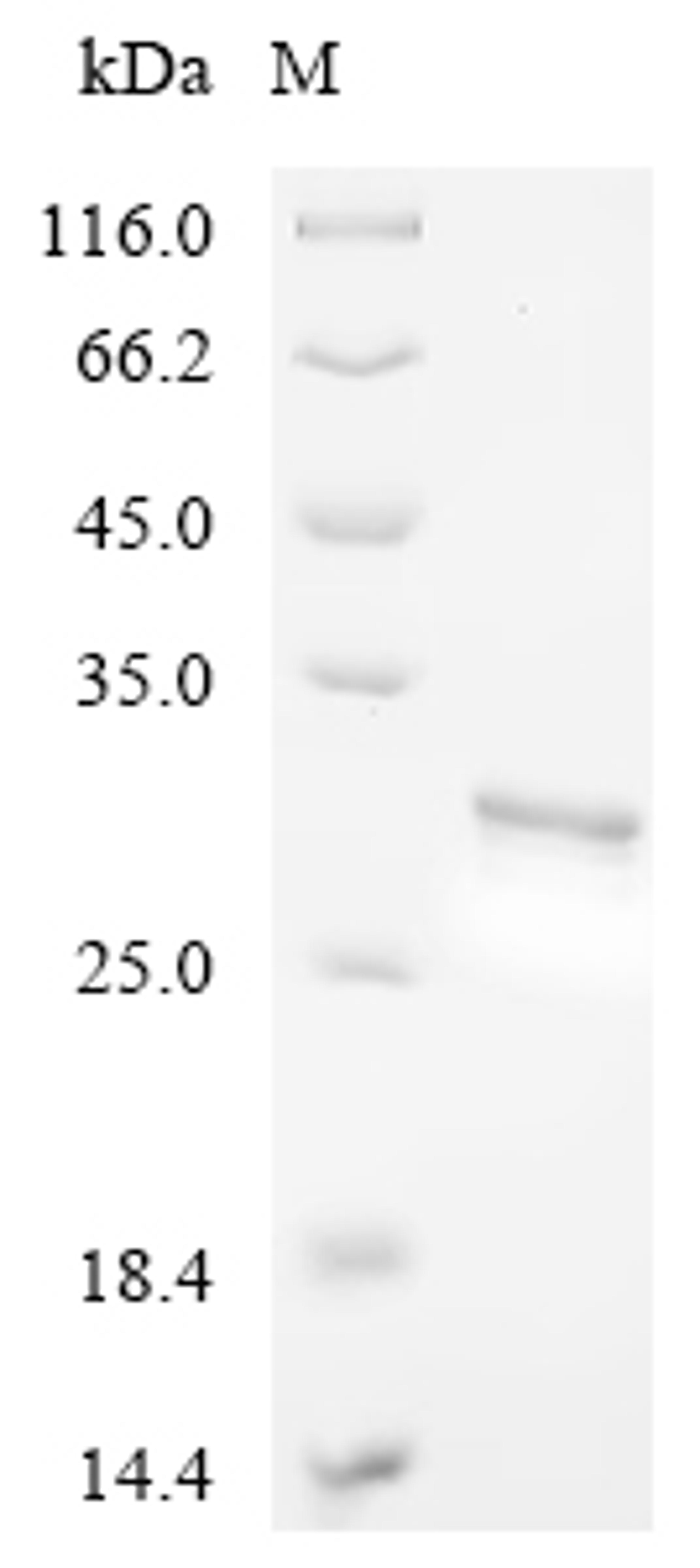 (Tris-Glycine gel) Discontinuous SDS-PAGE (reduced) with 5% enrichment gel and 15% separation gel.