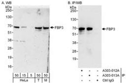 Detection of human and mouse FBP3 by western blot (h&m) and immunoprecipitation (h).