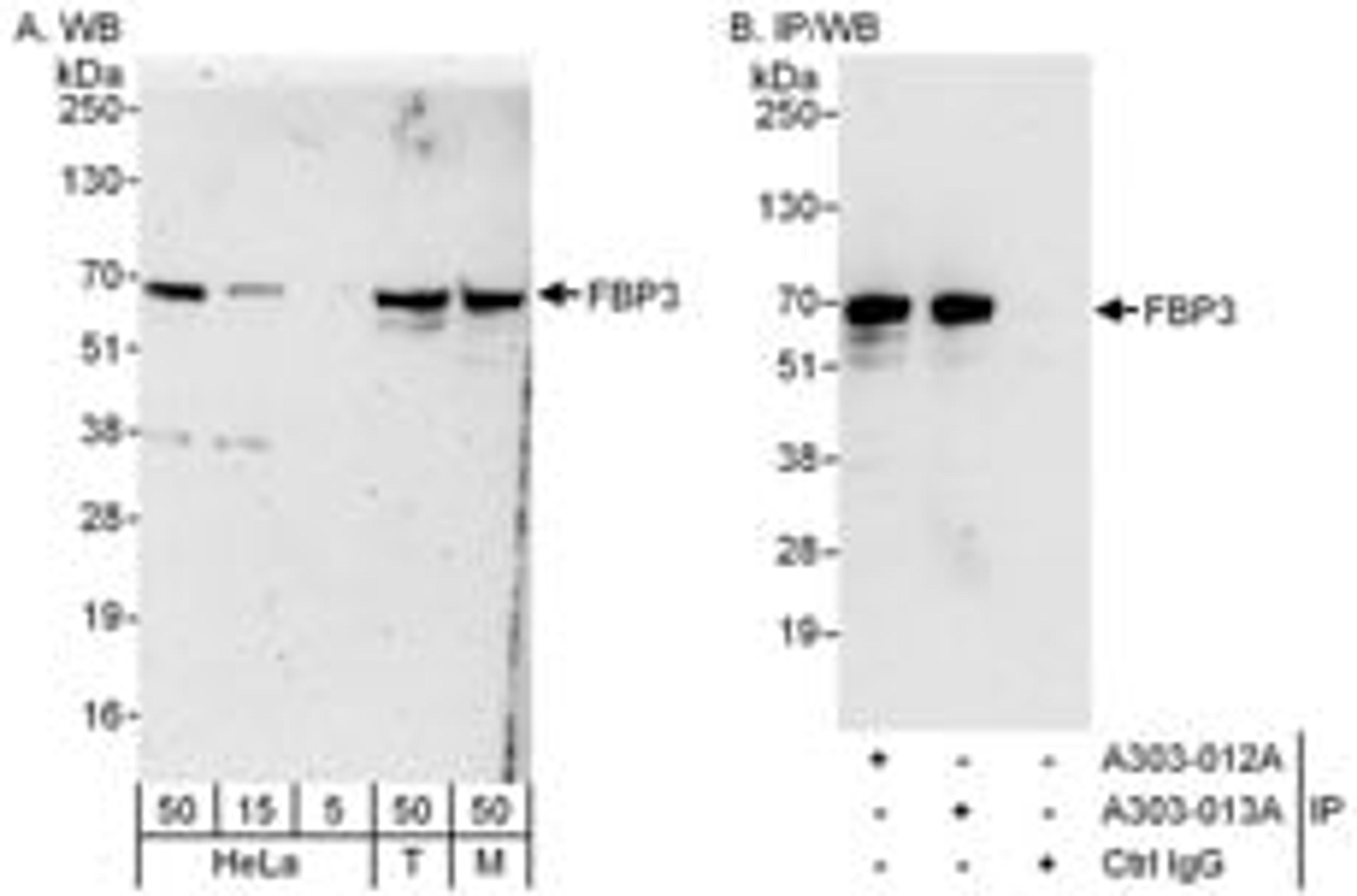 Detection of human and mouse FBP3 by western blot (h&m) and immunoprecipitation (h).