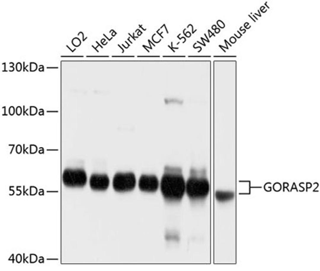 Western blot - GORASP2 antibody (A10383)