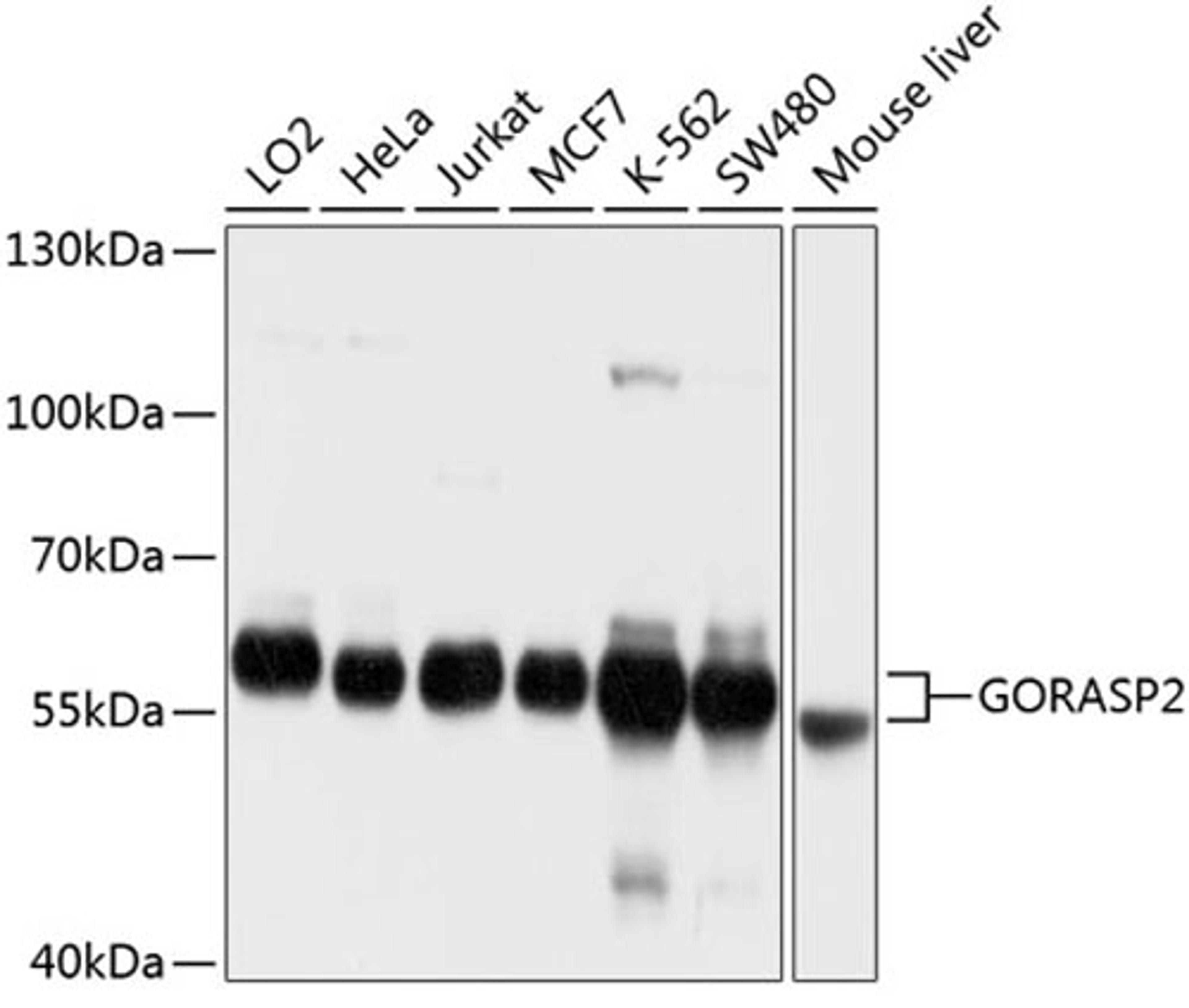 Western blot - GORASP2 antibody (A10383)