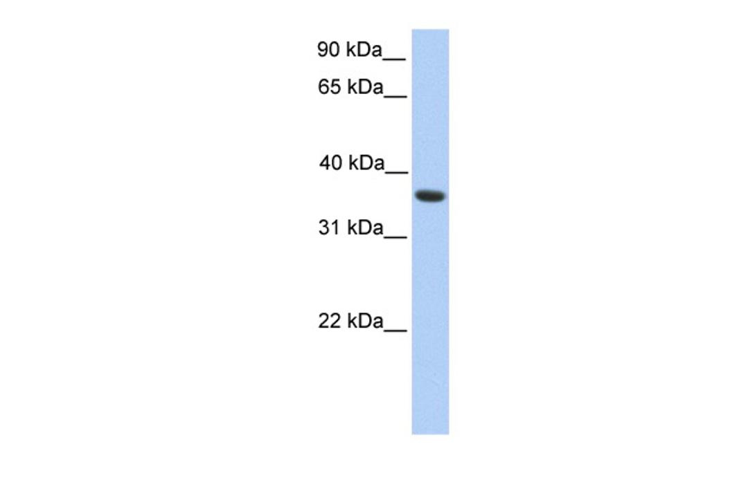 Antibody used in WB on Human HepG2 at 0.2-1 ug/ml.