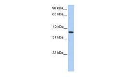 Antibody used in WB on Human HepG2 at 0.2-1 ug/ml.