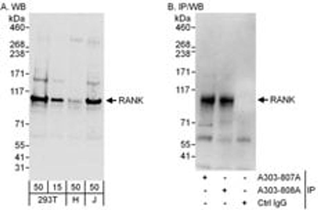 Detection of human RANK by western blot and immunoprecipitation.