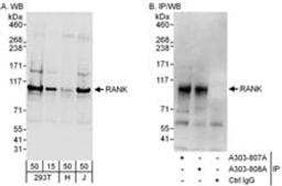 Detection of human RANK by western blot and immunoprecipitation.