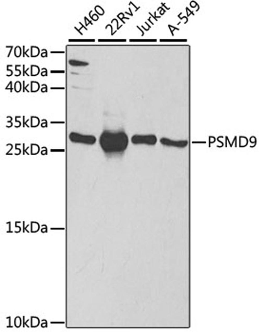 Western blot - PSMD9 antibody (A5357)