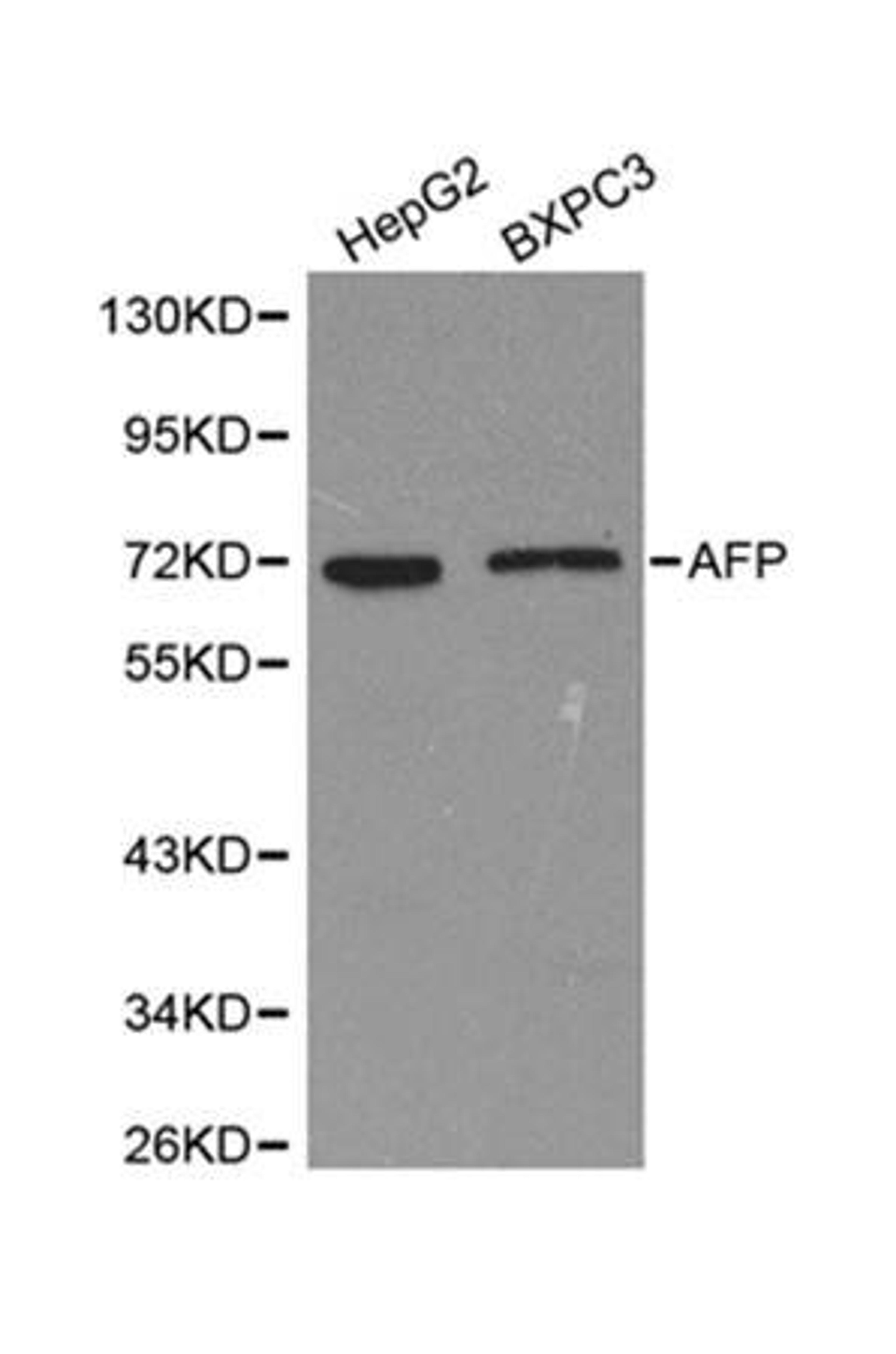 Western blot analysis of HepG2, BXPC3 cell line lysates using AFP   antibody