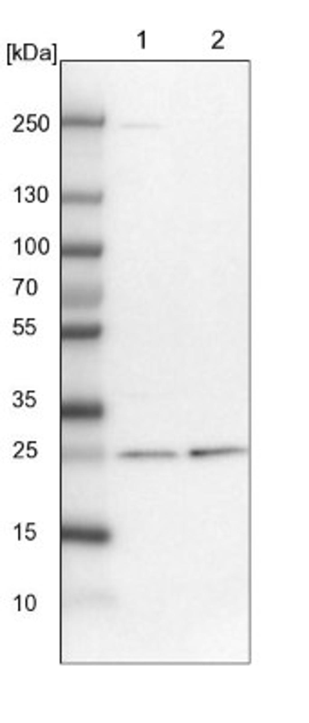 Western Blot: ETHE1 Antibody [NBP1-81689] - Lane 1: NIH-3T3 cell lysate (Mouse embryonic fibroblast cells)<br/>Lane 2: NBT-II cell lysate (Rat Wistar bladder tumour cells)