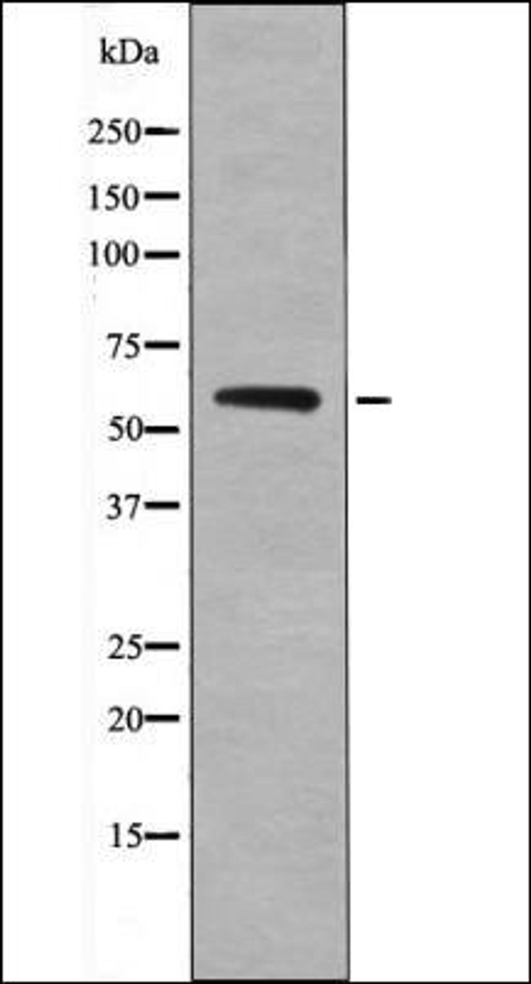 Western blot analysis of heatshock treated HT29 whole cell lysates using Smad2 -Phospho-Ser255- antibody