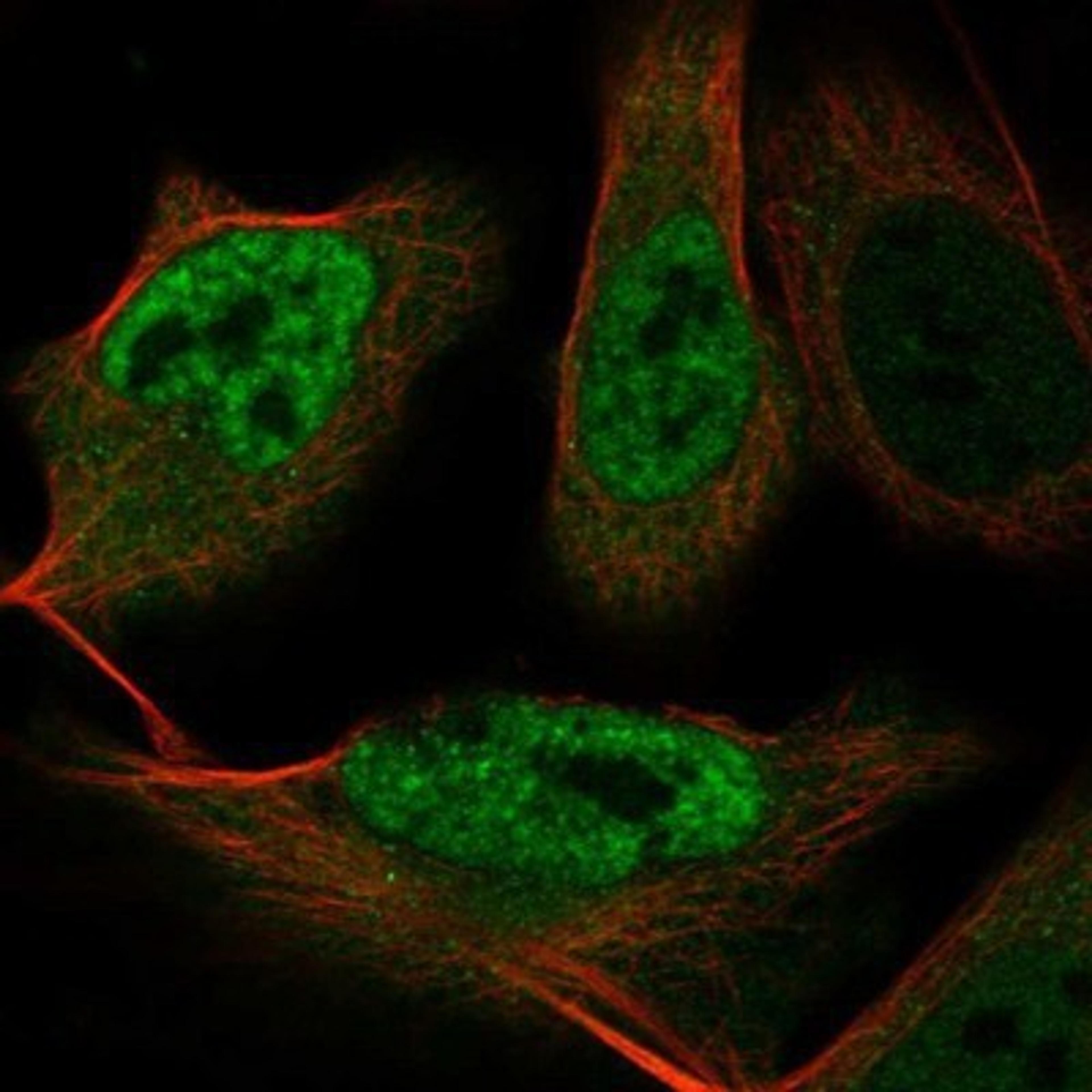 Immunocytochemistry/Immunofluorescence: EFTUD2 Antibody [NBP1-87019] - Staining of human cell line U-2 OS shows positivity in nucleus but not nucleoli.