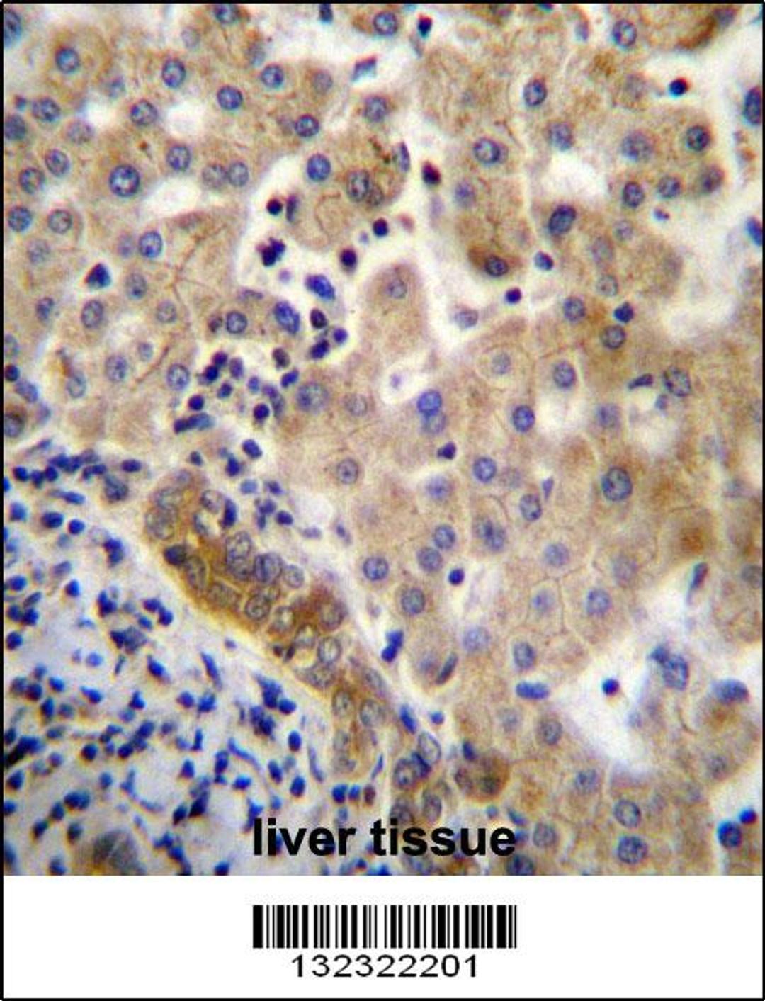 LIN7C Antibdy immunohistochemistry analysis in formalin fixed and paraffin embedded human liver tissue followed by peroxidase conjugation of the secondary antibody and DAB staining.This data demonstrates the use of LIN7C Antibdy for immunohistochemistry.