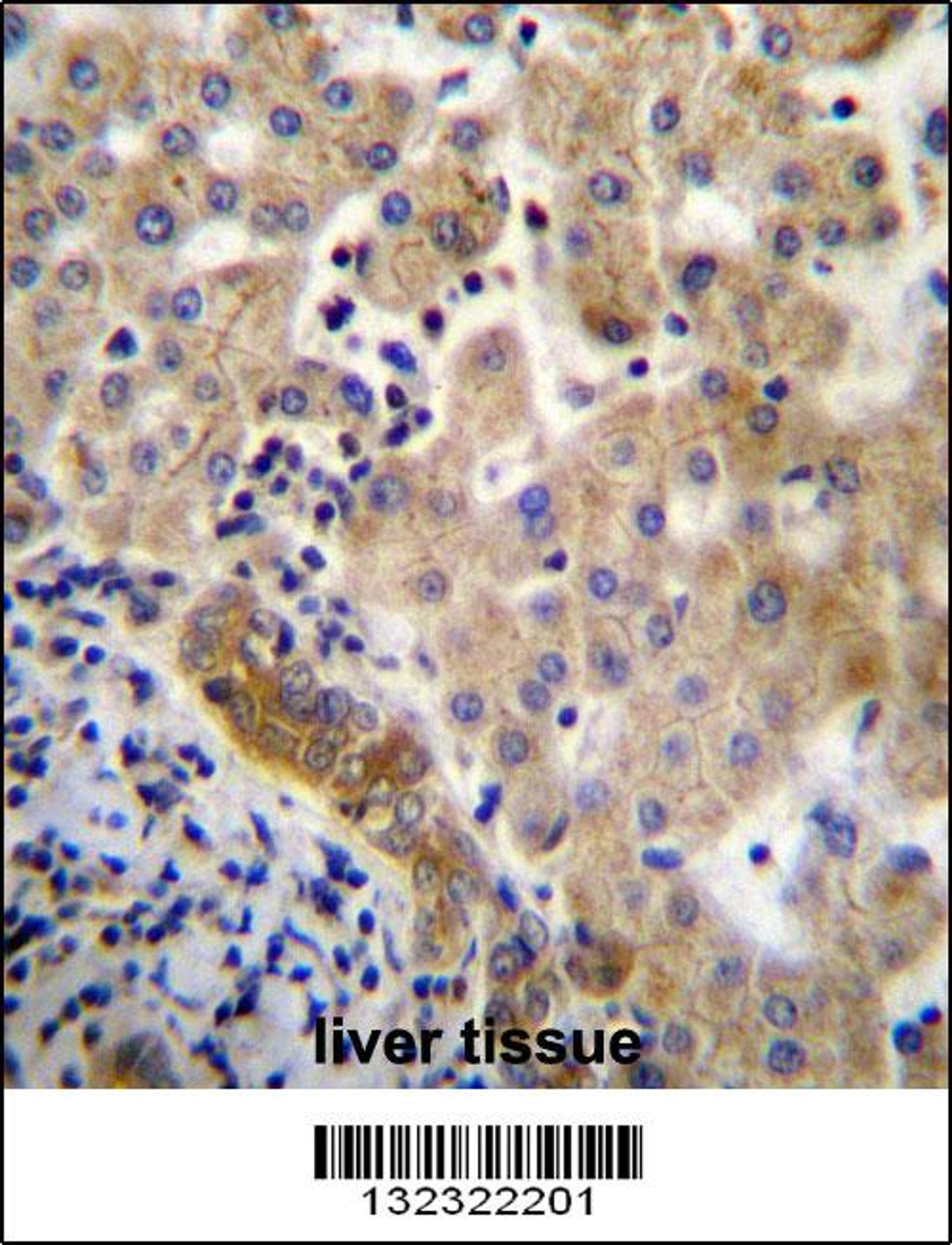 LIN7C Antibdy immunohistochemistry analysis in formalin fixed and paraffin embedded human liver tissue followed by peroxidase conjugation of the secondary antibody and DAB staining.This data demonstrates the use of LIN7C Antibdy for immunohistochemistry.