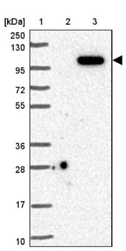 Western Blot: DNAJC16 Antibody [NBP1-81454] - Lane 1: Marker [kDa] 250, 130, 95, 72, 55, 36, 28, 17, 10<br/>Lane 2: Negative control (vector only transfected HEK293T lysate)<br/>Lane 3: Over-expression lysate (Co-expressed with a C-terminal myc-DDK tag (~3.1 kDa) in mammalian HEK293T cells, LY414676)