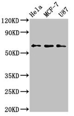 Western Blot. Positive WB detected in: Hela whole cell lysate, MCF-7 whole cell lysate, U87 whole cell lysate. All lanes: KY antibody at 3.2µg/ml. Secondary. Goat polyclonal to rabbit IgG at 1/50000 dilution. Predicted band size: 64, 42, 73, 76 kDa. Observed band size: 64 kDa