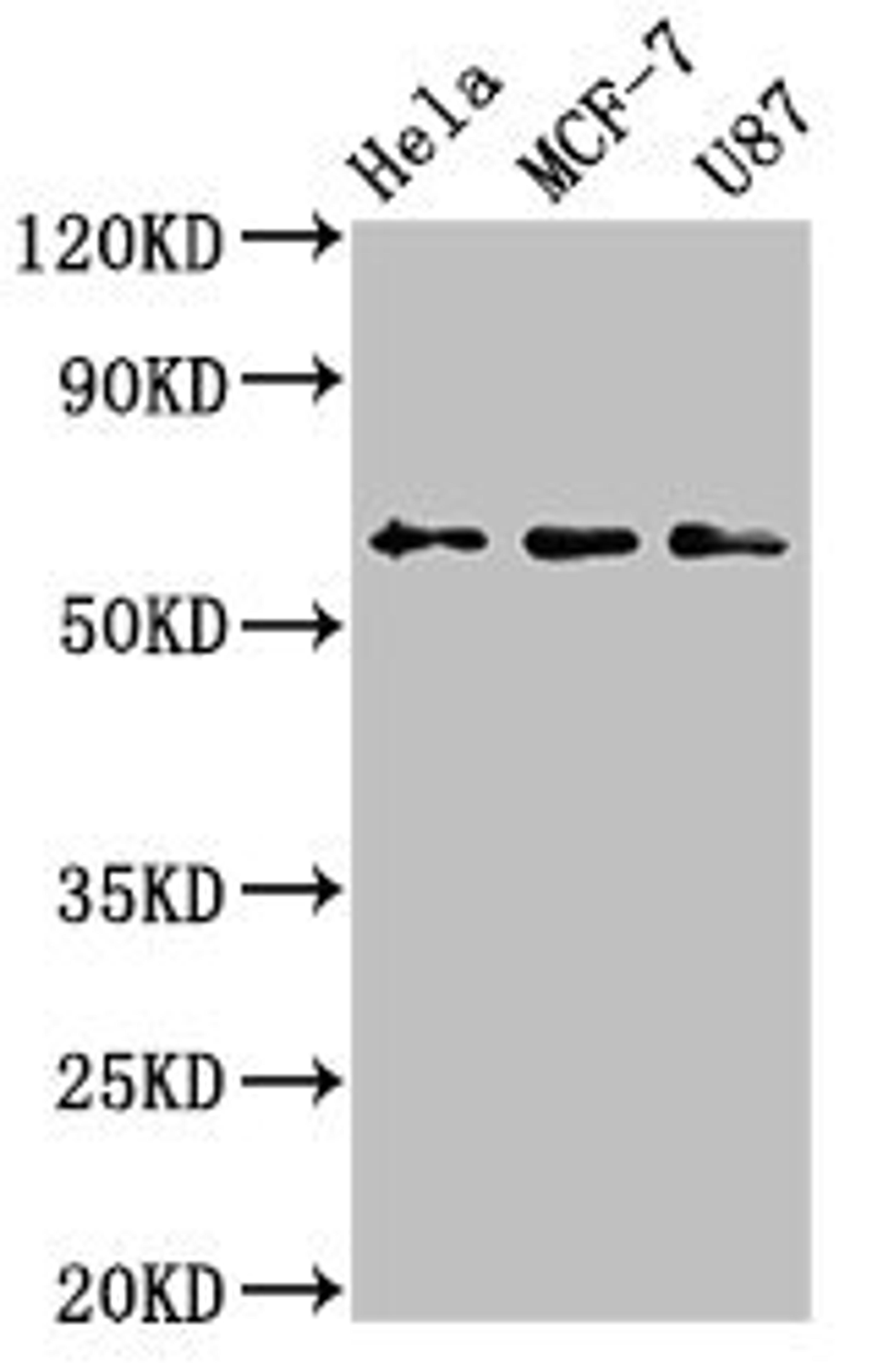 Western Blot. Positive WB detected in: Hela whole cell lysate, MCF-7 whole cell lysate, U87 whole cell lysate. All lanes: KY antibody at 3.2µg/ml. Secondary. Goat polyclonal to rabbit IgG at 1/50000 dilution. Predicted band size: 64, 42, 73, 76 kDa. Observed band size: 64 kDa