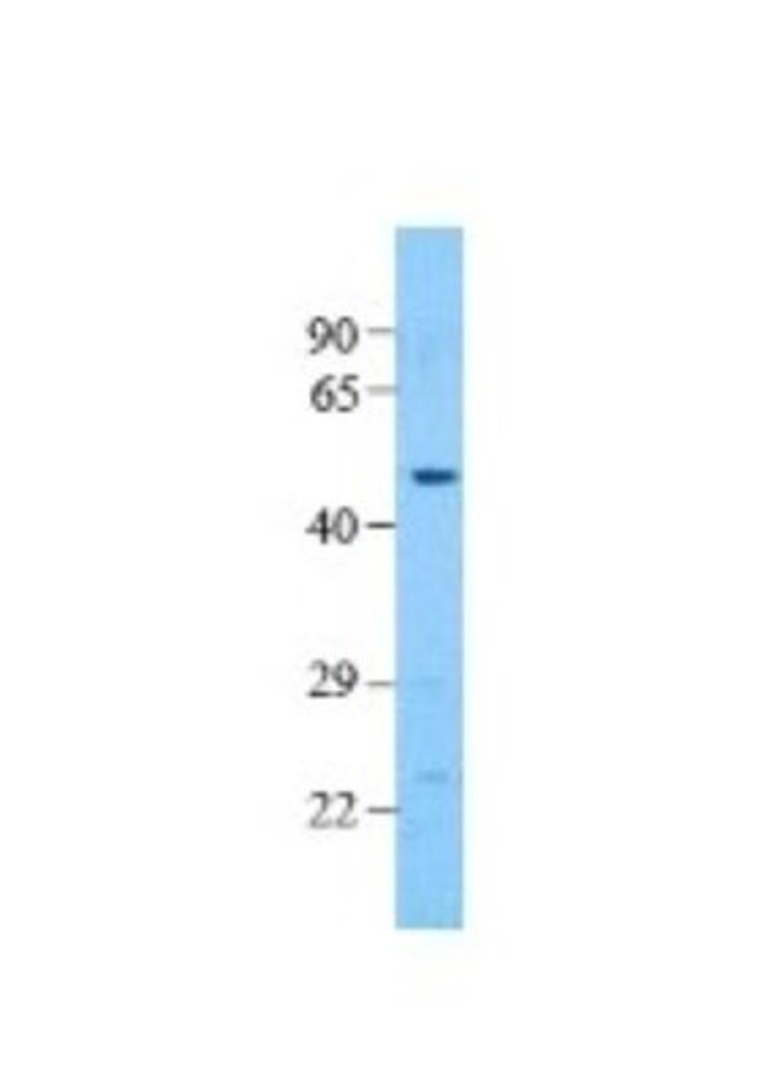 Immunohistochemistry: Pannexin-1 Antibody [NBP1-59672] - Human Jurkat cell lysate Antibody Dilution: 1.0 ug/ml.