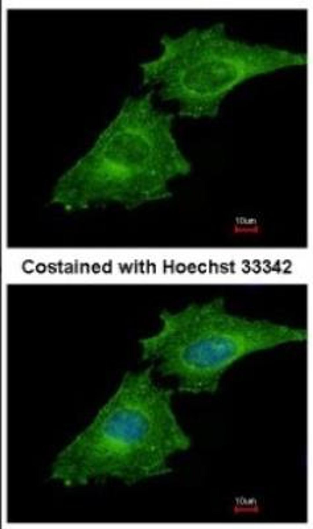 Immunocytochemistry/Immunofluorescence: Coronin 3 Antibody [NBP2-15968] - Immunofluorescence analysis of methanol-fixed HeLa, using antibody at 1:500 dilution.