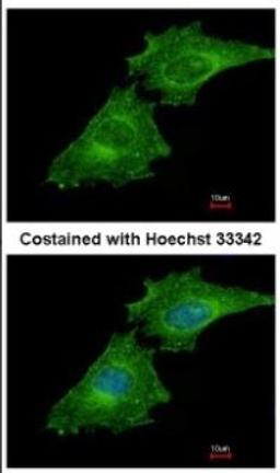 Immunocytochemistry/Immunofluorescence: Coronin 3 Antibody [NBP2-15968] - Immunofluorescence analysis of methanol-fixed HeLa, using antibody at 1:500 dilution.