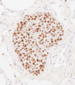 Detection of human MCM2 by immunohistochemistry.