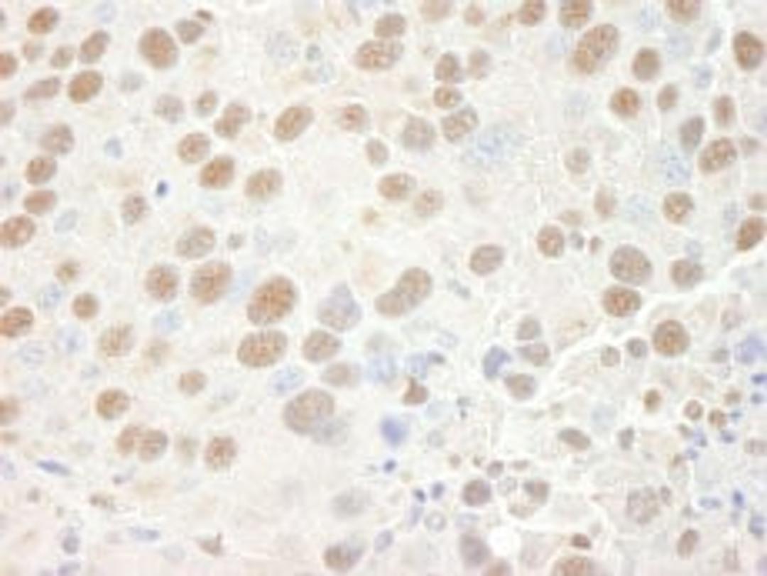 Detection of mouse CPSF68 by immunohistochemistry.