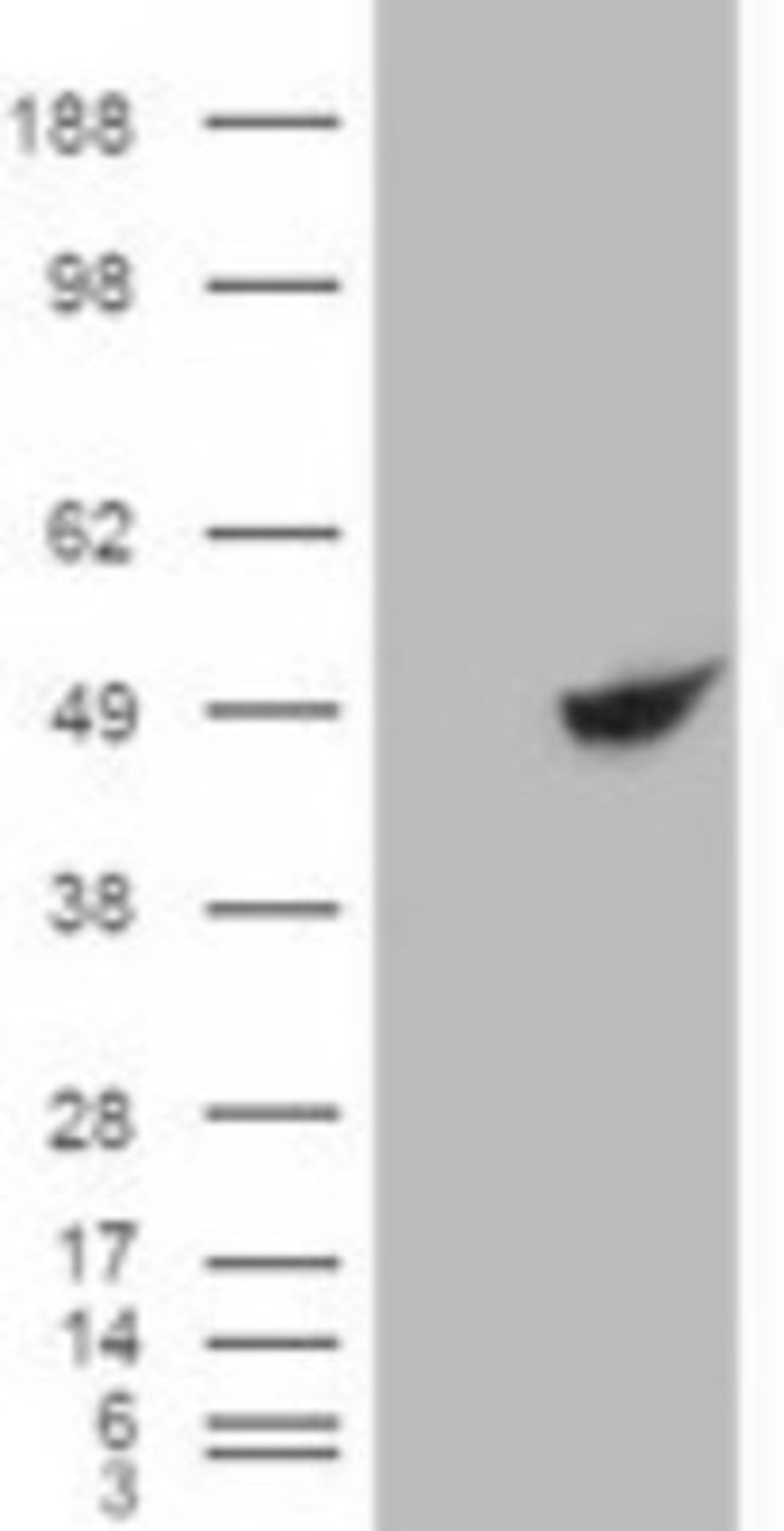 Western Blot: BHMT Antibody [NBP1-00161] - HEK293 overexpressing BHMT and probed with this antibody (mock transfection in first lane).