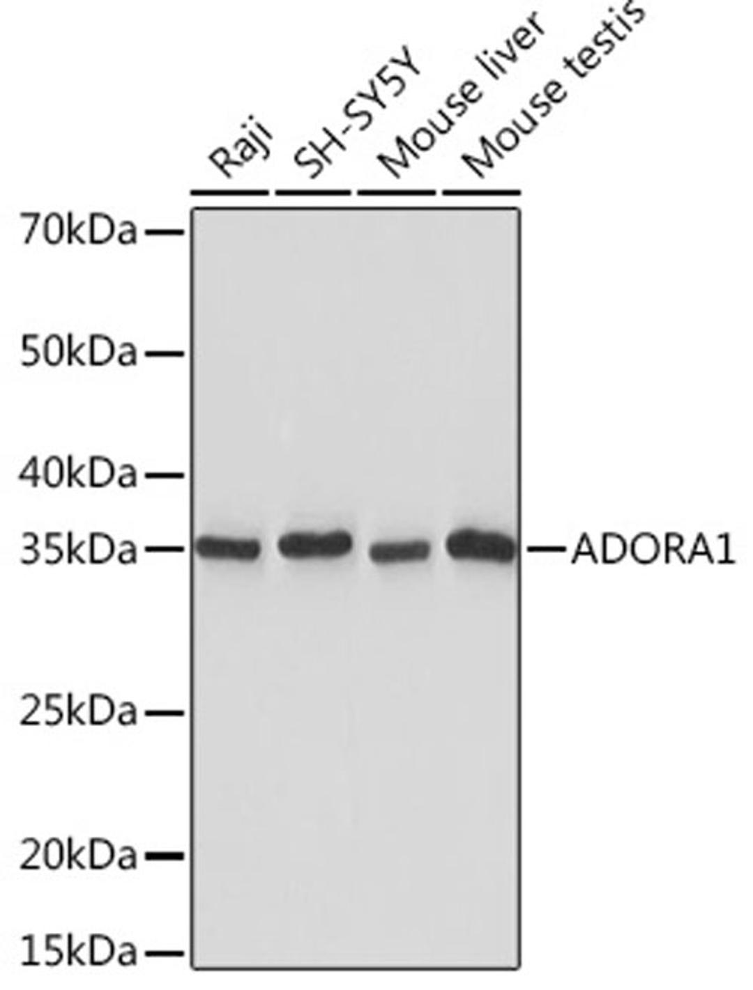 Western blot - ADORA1 Rabbit mAb (A5219)