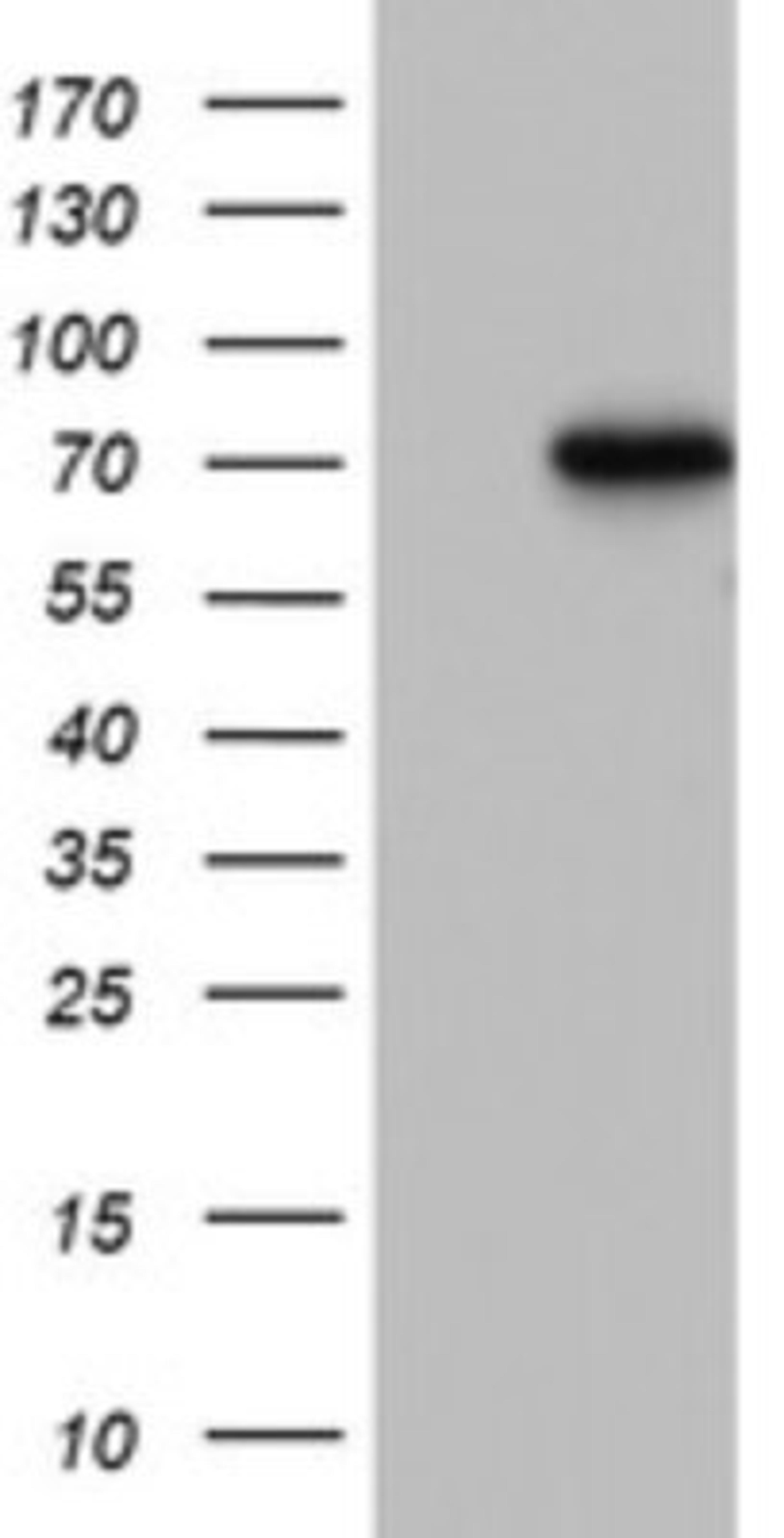 Western Blot: PARN Antibody (4D12) [NBP2-46321] - Analysis of HEK293T cells were transfected with the pCMV6-ENTRY control (Left lane) or pCMV6-ENTRY PARN.