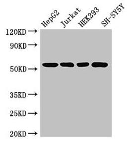 Western Blot. Positive WB detected in: HepG2 whole cell lysate, Jurkat whole cell lysate, HEK293 whole cell lysate, SH-SY5Y whole cell lysate. All lanes: DCTN4 antibody at 3.4ug/ml. Secondary. Goat polyclonal to rabbit IgG at 1/50000 dilution. Predicted band size: 53, 46, 54 kDa. Observed band size: 53 kDa. 
