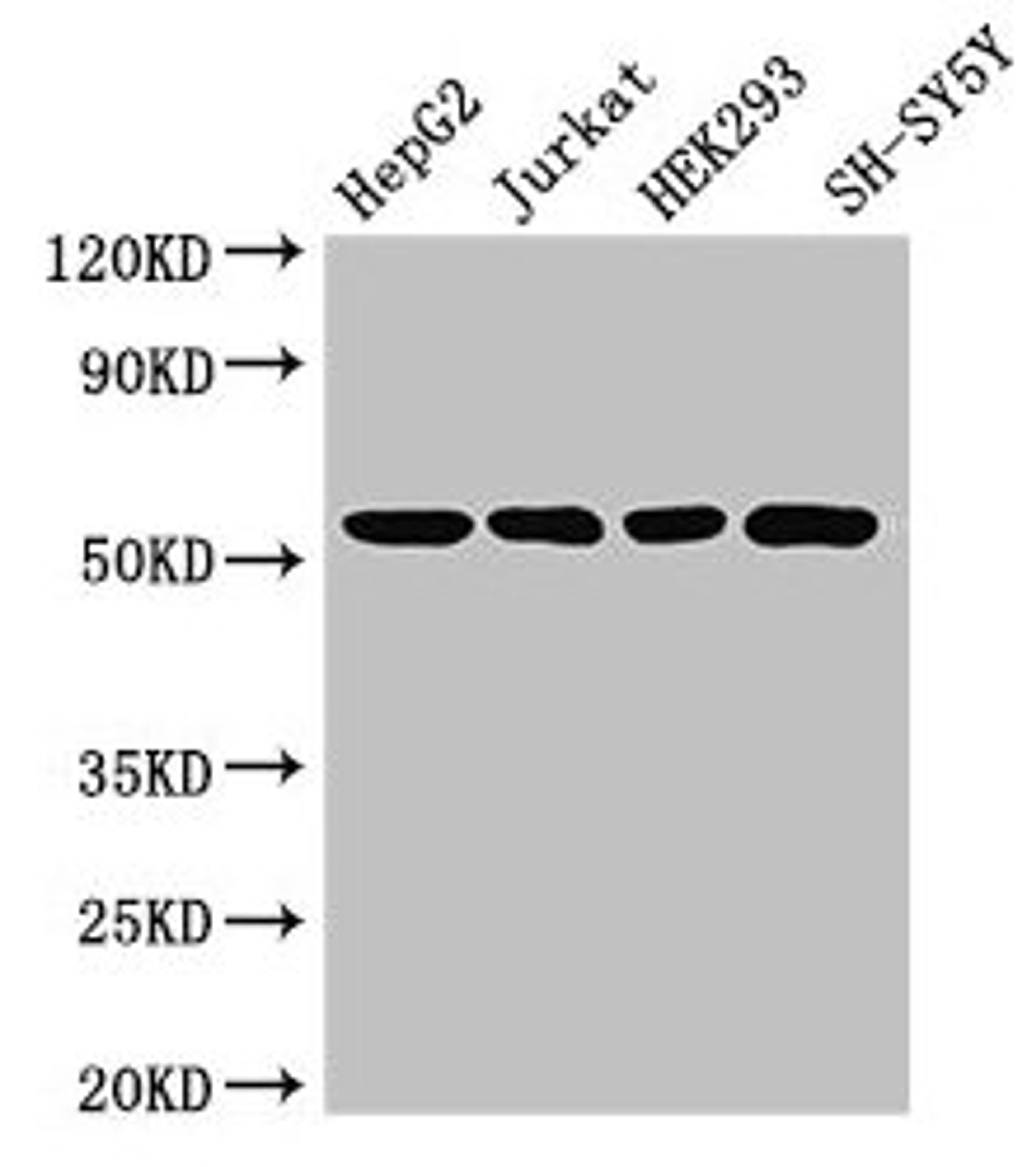 Western Blot. Positive WB detected in: HepG2 whole cell lysate, Jurkat whole cell lysate, HEK293 whole cell lysate, SH-SY5Y whole cell lysate. All lanes: DCTN4 antibody at 3.4ug/ml. Secondary. Goat polyclonal to rabbit IgG at 1/50000 dilution. Predicted band size: 53, 46, 54 kDa. Observed band size: 53 kDa. 