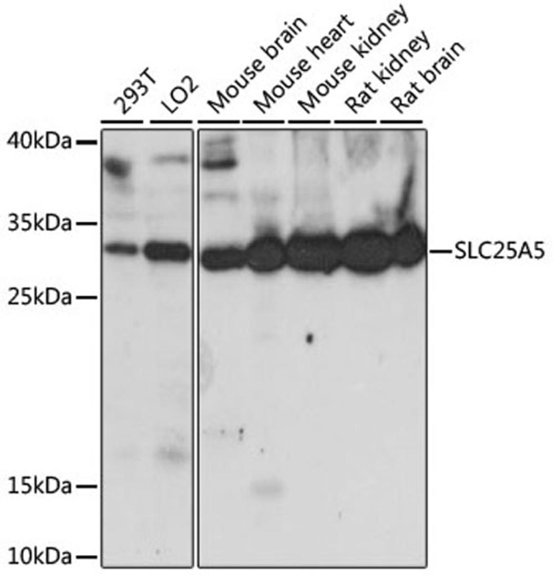 Western blot - SLC25A5 antibody (A15639)