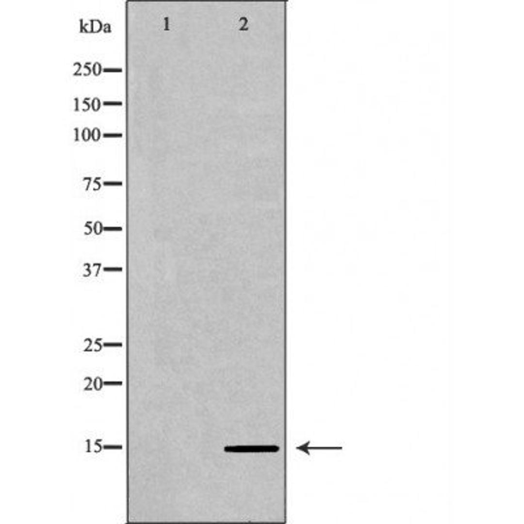 Western blot analysis of HeLa cell line and H3 protein expressed in E.coli using Histone H3K36me2 antibody